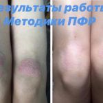 Психо-функциональная разблокировка